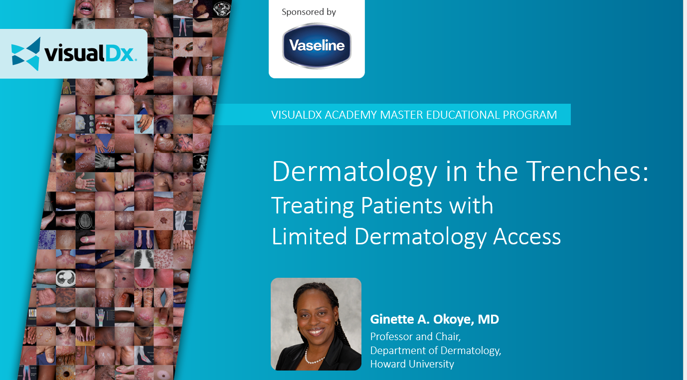 Picture of Dr. Ginitte Okoye's Webinar: Dermatology in the Trenches: Treating Patients with Limited Dermatology Access
